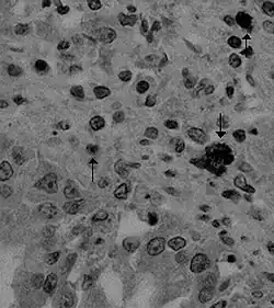 Canine coronavirus antigen (arrows) in canine lung tissue