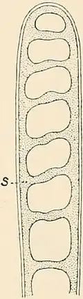 "Climacosphenia moniligera", section of upper portion of cell to show the perforated septum (s). By George Stephen West after Otto Friedrich Müller.