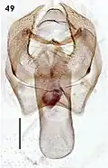 Male genitalia