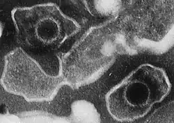 Electron microscopic image of two Epstein–Barr virus virions (viral particles) showing round capsids (protein-encased genetic material) loosely surrounded by the membrane envelope