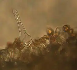 A translucent, pointed cell with a rounded tip extending upwards into a clear area. Its base is embedded amongst a layer of poorly-resolved smaller cells most of which are attached to up to four smaller oval brownish cells.