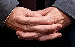 L-phenotype hand clasping