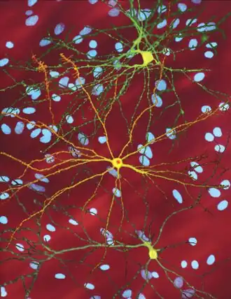 Several neurons colored yellow and having a large central core with up to two dozen tendrils branching out of them, the core of the neuron in the foreground contains an orange blob about a quarter of its diameter