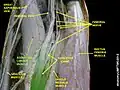 Adductor longus muscle