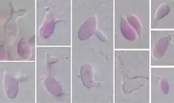 Oval to irregularly shaped single-celled yeast of Sporobolomyces salmonicolor showing characteristic "arthritic-finger"-shaped sterigmata