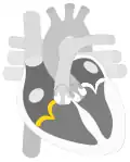 Tricuspid valve marked in yellow.