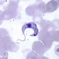Trypanosoma cruzi, the causative agent of Chagas disease