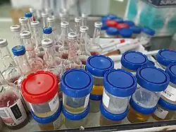 A variety of microbiological samples in a laboratory